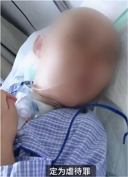 山西12岁女孩被继母打成植物人什么情况?画面曝光皮肤多处溃烂出血惨不忍睹