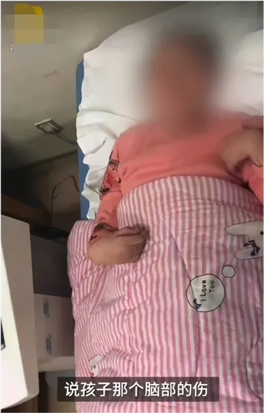 山西12岁女孩被继母打成植物人什么情况?画面曝光皮肤多处溃烂出血惨不忍睹