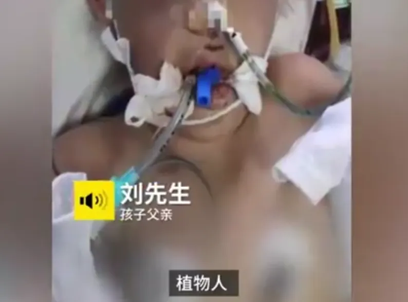 山西12岁女孩被继母打成植物人什么情况?画面曝光皮肤多处溃烂出血惨不忍睹