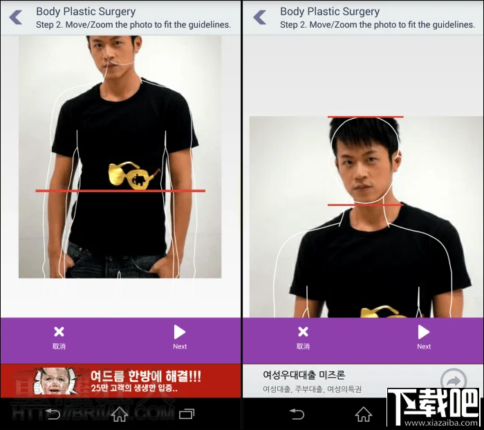 bodyplasticsurgery_4