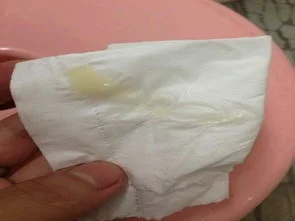 金蝶进销存官网怀孕白带 | 怀孕初期白带症状,怀孕初期白带的变化?在线等